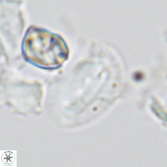 Helicosphaera dyoporous VR 05491