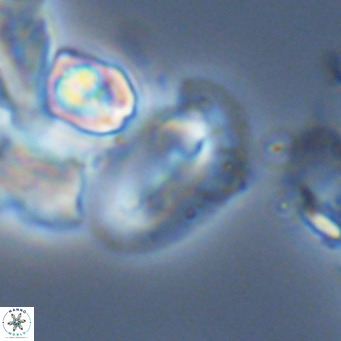 Helicosphaera dyoporous VR 05492