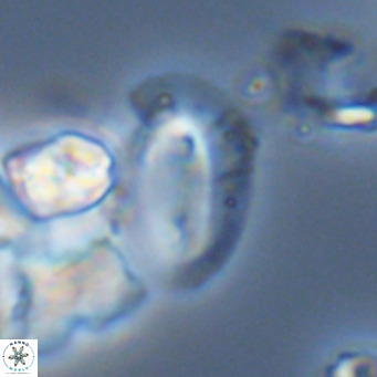 Helicosphaera dyoporous VR 05493