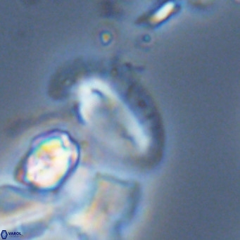 Helicosphaera dyoporous VR 05494