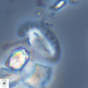 Helicosphaera dyoporous VR 05494