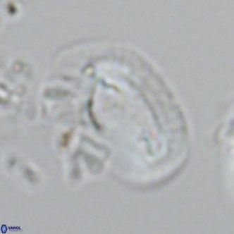 Helicosphaera dyoporous VR 05941