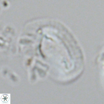 Helicosphaera dyoporous VR 05941