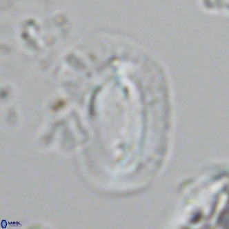 Helicosphaera dyoporous VR 05942