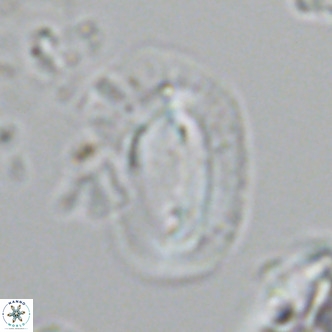 Helicosphaera dyoporous VR 05942