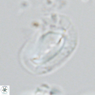 Helicosphaera dyoporous VR 05944