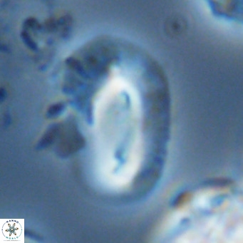 Helicosphaera dyoporous VR 05946