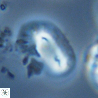 Helicosphaera dyoporous VR 05947