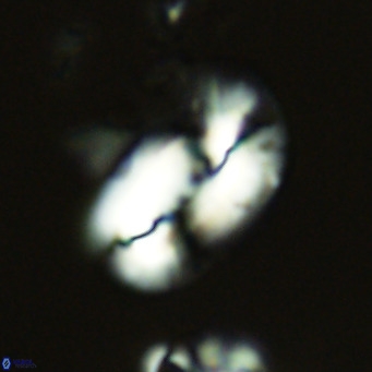 Helicosphaera dyoporous VR 05932