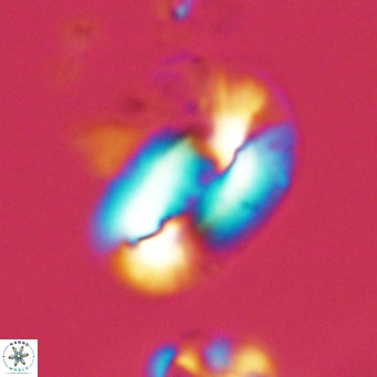 Helicosphaera dyoporous VR 05933