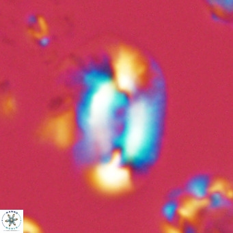 Helicosphaera dyoporous VR 05934