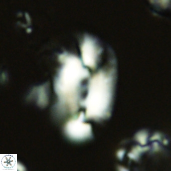 Helicosphaera dyoporous VR 05935