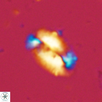 Helicosphaera dyoporous VR 06015
