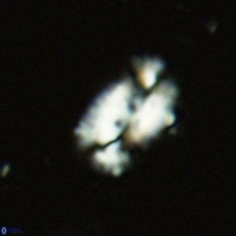 Helicosphaera dyoporous VR 06017