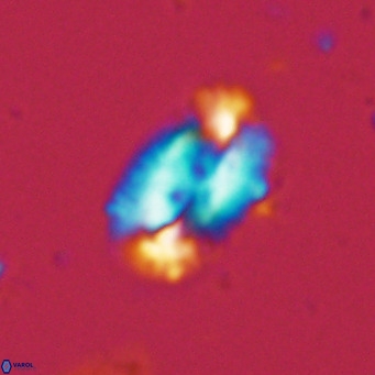 Helicosphaera dyoporous VR 06018