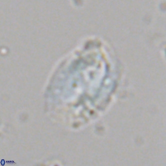 Helicosphaera dyoporous VR 06020