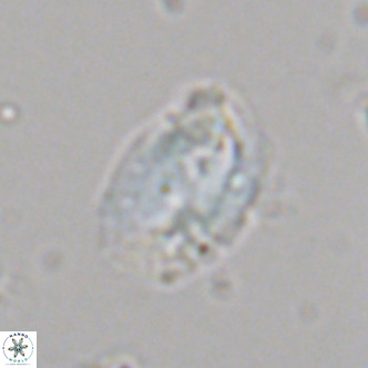 Helicosphaera dyoporous VR 06020