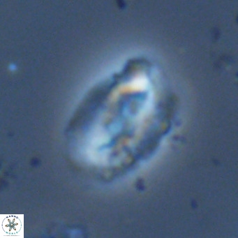 Helicosphaera dyoporous VR 06027