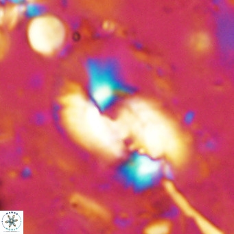 Helicosphaera dyoporous VR 07840