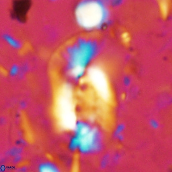 Helicosphaera dyoporous VR 07841