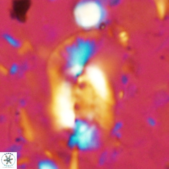 Helicosphaera dyoporous VR 07841