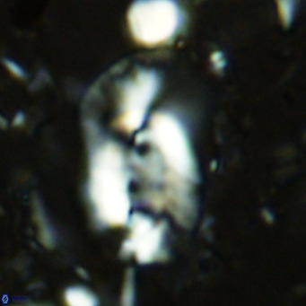 Helicosphaera dyoporous VR 07842