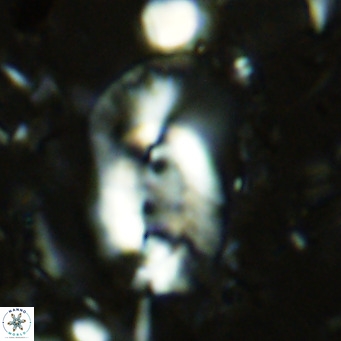 Helicosphaera dyoporous VR 07842