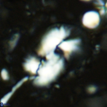 Helicosphaera dyoporous VR 07843