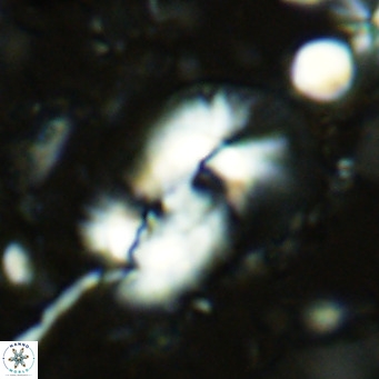 Helicosphaera dyoporous VR 07843