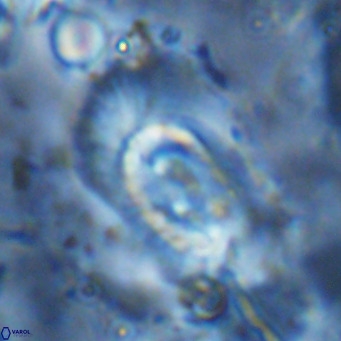 Helicosphaera dyoporous VR 05482
