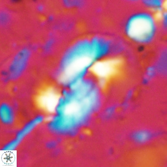 Helicosphaera dyoporous VR 07844