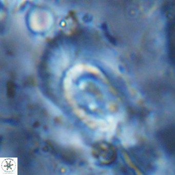 Helicosphaera dyoporous VR 07847
