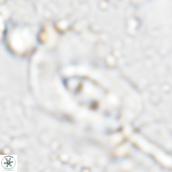 Helicosphaera dyoporous VR 07850
