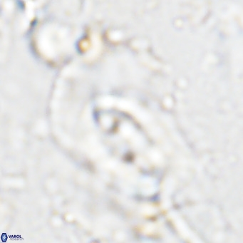 Helicosphaera dyoporous VR 05482