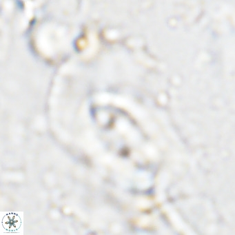 Helicosphaera dyoporous VR 05482