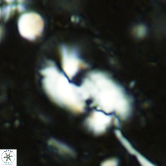 Helicosphaera dyoporous VR 07839