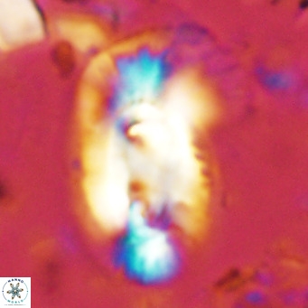Helicosphaera dyoporous VR 08277