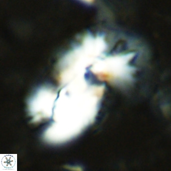 Helicosphaera dyoporous VR 08279