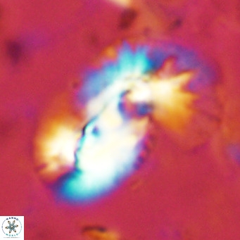 Helicosphaera dyoporous VR 08280