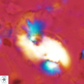 Helicosphaera dyoporous VR 08281