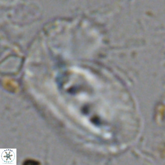 Helicosphaera dyoporous VR 08285