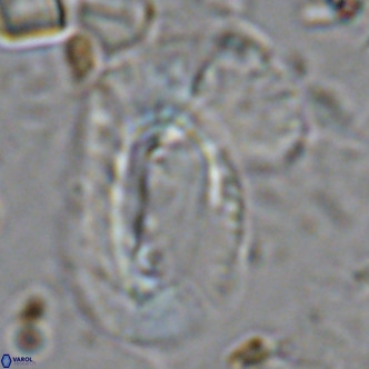 Helicosphaera dyoporous VR 08286