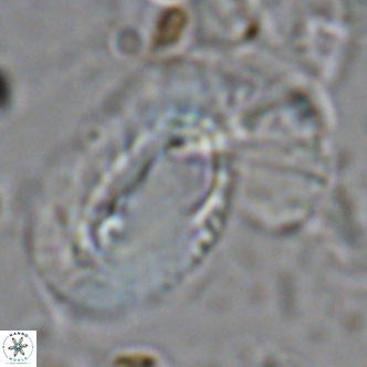 Helicosphaera dyoporous VR 08287