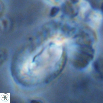 Helicosphaera dyoporous VR 08288
