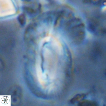 Helicosphaera dyoporous VR 08289