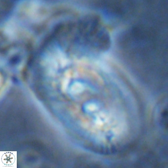 Helicosphaera dyoporous VR 08291