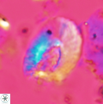 Helicosphaera dinesenii 1978