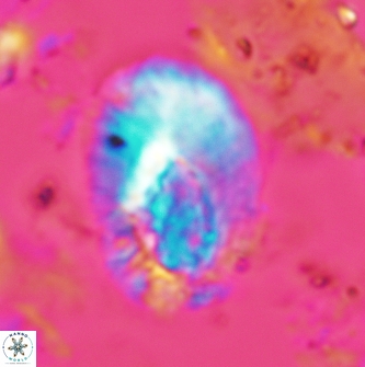 Helicosphaera dinesenii 1979
