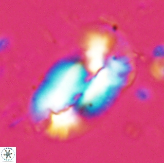 Helicosphaera distincta 29844