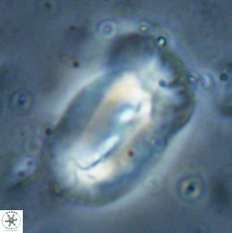 Helicosphaera distincta 29852